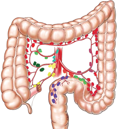 Viêm hạch mạc treo - Hình ảnh minh họa